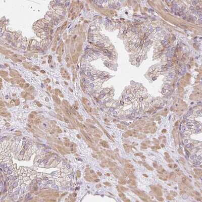 Immunohistochemistry-Paraffin: Sulfatase 1 Antibody [NBP2-31584]