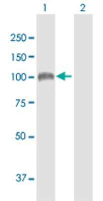 Western Blot: Sulfatase 1 Antibody [H00023213-B01P]