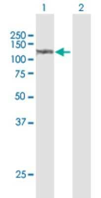 Western Blot: Sulfatase 1 Antibody [H00023213-D01P]