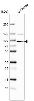 Western Blot: Sulfatase 1 Antibody [NBP2-31584]