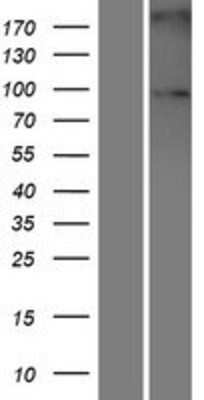 Western Blot: Sulfatase-2/SULF2 Overexpression Lysate [NBL1-16599]