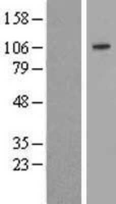 Western Blot: Sulfatase-2/SULF2 Overexpression Lysate [NBP2-06760]