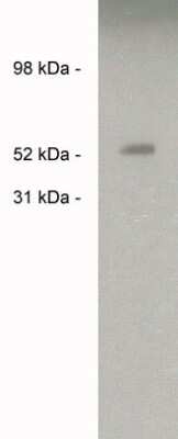 Western Blot: Sulfatase-2/SULF2 Antibody [NBP3-11910]