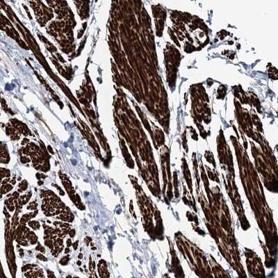 Immunohistochemistry-Paraffin: Sulfatase Modifying Factor 1/SUMF1 Antibody [NBP1-83905]