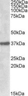 Western Blot: Sulfatase Modifying Factor 1/SUMF1 Antibody [NBP1-45212]