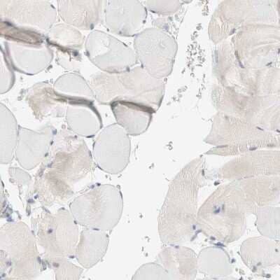 Immunohistochemistry-Paraffin: Sulfatase Modifying Factor 2/SUMF2 Antibody [NBP1-84145]