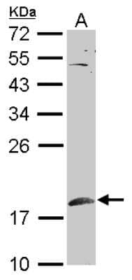 Western Blot: SUMO1 Antibody [NBP2-20532]