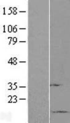 Western Blot: SUMO1 Overexpression Lysate [NBL1-16612]