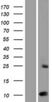 Western Blot: SUMO2 Overexpression Lysate [NBP2-10389]