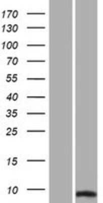 Western Blot: SUMO2 Overexpression Lysate [NBP2-10752]