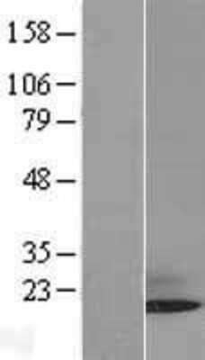 Western Blot: SUMO3 Overexpression Lysate [NBL1-16613]