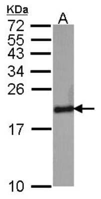 Western Blot: SOD1/Cu-Zn SOD Antibody [NBP2-20534]
