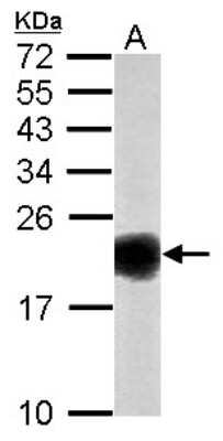 Western Blot: SOD1/Cu-Zn SOD Antibody [NBP2-20534]