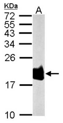 Western Blot: SOD1/Cu-Zn SOD Antibody [NBP2-20534]
