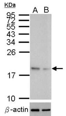 Western Blot: SOD1/Cu-Zn SOD Antibody [NBP2-20534]