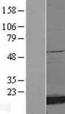 Western Blot: SOD1/Cu-Zn SOD Overexpression Lysate [NBL1-16332]