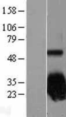 Western Blot: SOD2/Mn-SOD Overexpression Lysate [NBL1-16333]