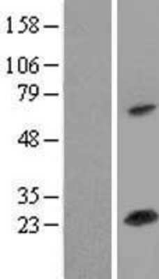 Western Blot: SOD2/Mn-SOD Overexpression Lysate [NBL1-16334]