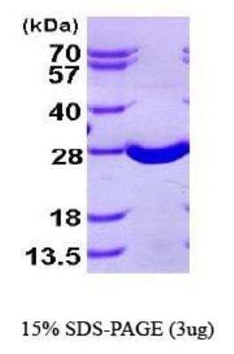 SDS-PAGE: Recombinant Human SOD2/Mn-SOD His Protein [NBP1-41138]