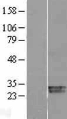 Western Blot: SOD3/EC-SOD Overexpression Lysate [NBL1-16335]