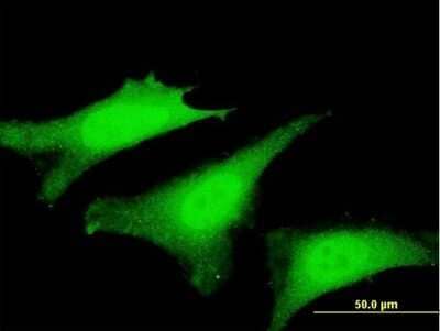 Immunocytochemistry/ Immunofluorescence: Supervillin Antibody (6E10) [H00006840-M03]