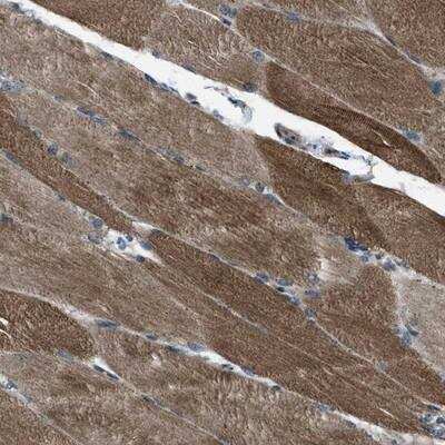 Immunohistochemistry: Supervillin Antibody [NBP1-87559]