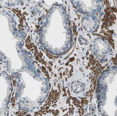 Immunohistochemistry-Paraffin: Supervillin Antibody [NBP1-90363]