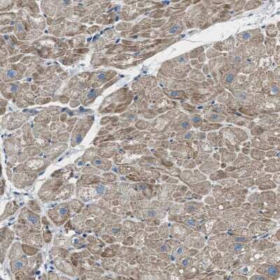 Immunohistochemistry-Paraffin: Supervillin Antibody [NBP1-90363]