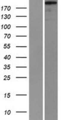 Western Blot: Supervillin Overexpression Lysate [NBP2-10875]