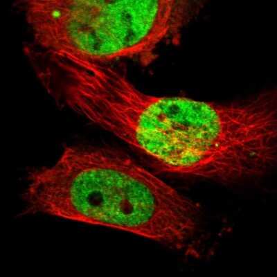 Immunocytochemistry/ Immunofluorescence: Suppressor of Fused Antibody [NBP1-87384]