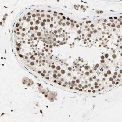 Immunohistochemistry-Paraffin: Suppressor of Fused Antibody [NBP1-87384]