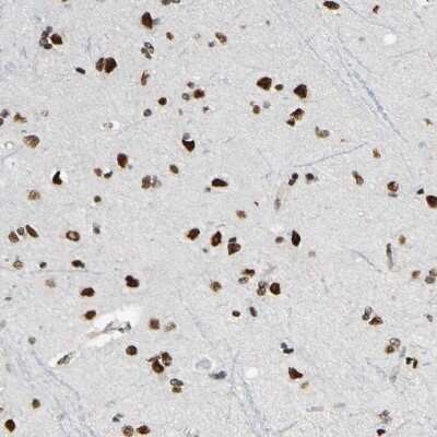 Immunohistochemistry-Paraffin: Suppressor of Fused Antibody [NBP1-87384]