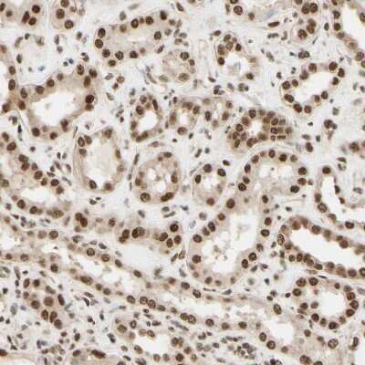 Immunohistochemistry-Paraffin: Suppressor of Fused Antibody [NBP1-87384]
