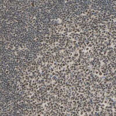 Immunohistochemistry-Paraffin: Suppressor of Fused Antibody [NBP1-87384]