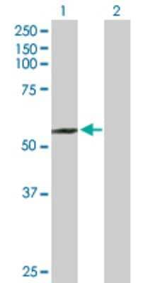 Western Blot: Suppressor of Fused Antibody [H00051684-D01P]