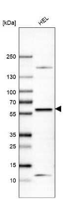 Western Blot: Suppressor of Fused Antibody [NBP1-87384]