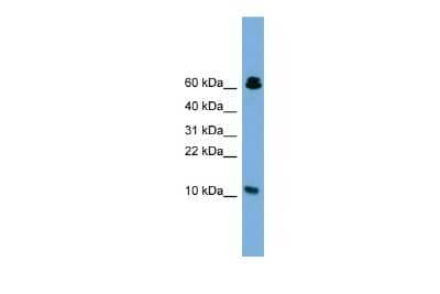 Western Blot: Suppressor of Ty 4 homolog 1 Antibody [NBP2-86835]