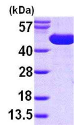Western Blot: Recombinant E. coli SurA His Protein [NBP1-46034]