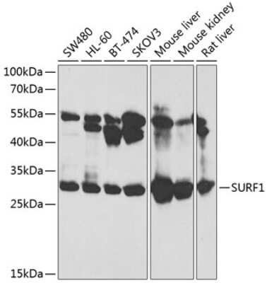 Western Blot: Surf1 AntibodyBSA Free [NBP2-95126]