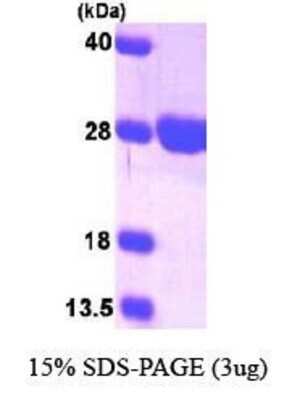 SDS-PAGE: Recombinant Human Surf1 His Protein [NBP1-30315]