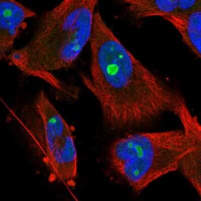 Immunocytochemistry/ Immunofluorescence: Surf6 Antibody [NBP1-83550]