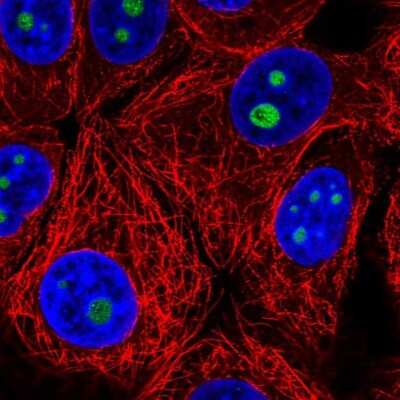 Immunocytochemistry/ Immunofluorescence: Surf6 Antibody [NBP2-57677]