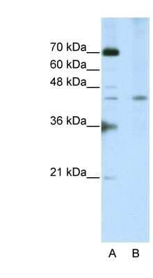 Western Blot: Surf6 Antibody [NBP1-57162]