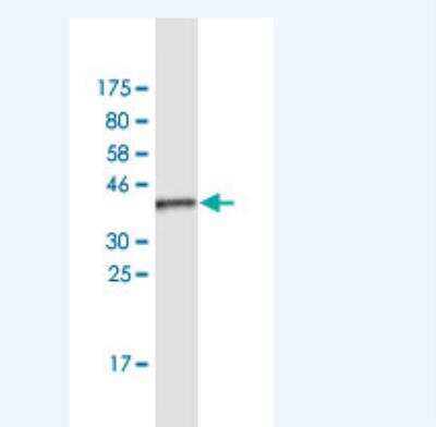 Western Blot: Surfactant Protein A Antibody (3E3) [H00653509-M04]