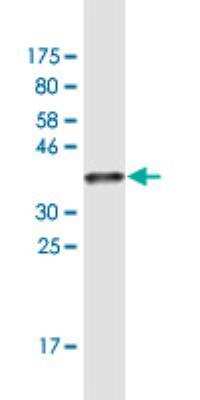 Western Blot: Surfactant Protein A Antibody (3H2) [H00653509-M05]