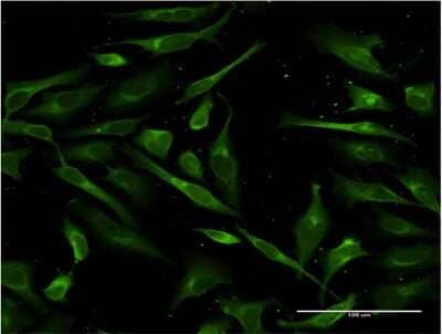 Immunocytochemistry/ Immunofluorescence: Surfactant Protein A Antibody (4C4) [H00653509-M06]