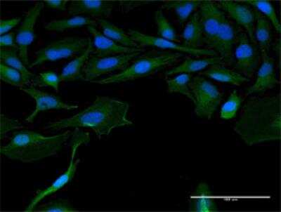 Immunocytochemistry/ Immunofluorescence: Surfactant Protein A Antibody (4D6) [H00653509-M07]