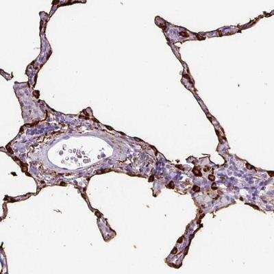 Immunohistochemistry-Paraffin: Surfactant Protein A Antibody [NBP2-46720]