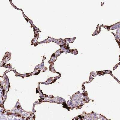 Immunohistochemistry-Paraffin: Surfactant Protein A Antibody [NBP2-46771]