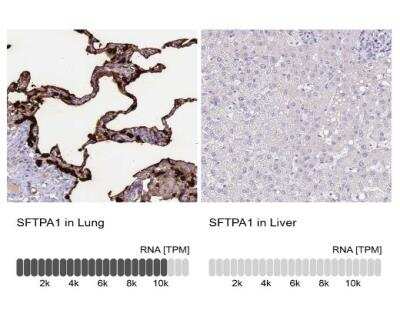 Immunohistochemistry-Paraffin: Surfactant Protein A Antibody [NBP2-46679]